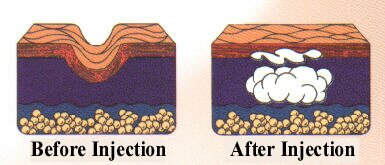 collagen cartoon.jpg (64784 bytes)