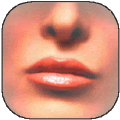 Restylane