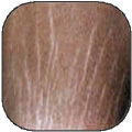 Stretch Marks/Scars