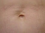 Titan ABD After Picture