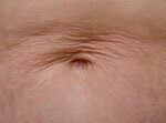 Titan ABD Before Picture